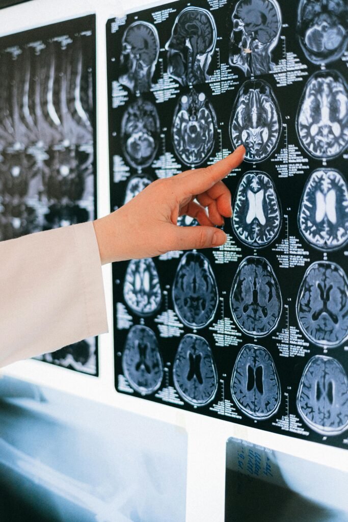 A doctor's hand points to a brain MRI scan on a lightbox, illustrating medical diagnosis