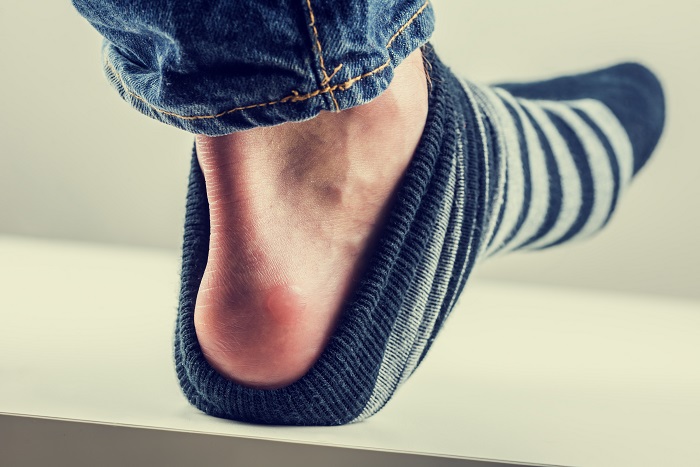Blisters on heel from court shoes