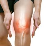 Runner's Knee Exercises for World Cup Athletes