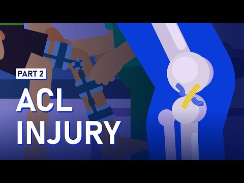 Knee Ligament Diagnosis, Treatment, and Rehabilitation